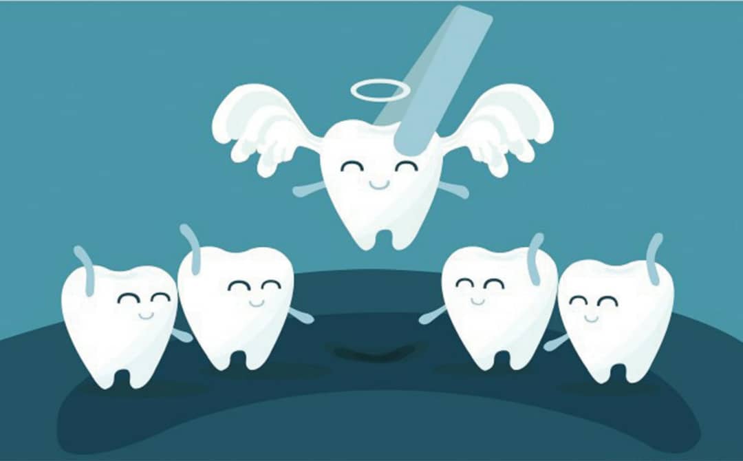 کشیدن دندان شیری در کلینیک دندانپزشکی آپادانا رشت